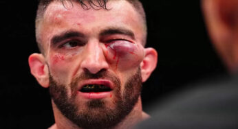 Cedera Parah Mohammad Yahya di UFC Abu Dhabi Gegerkan Penggemar