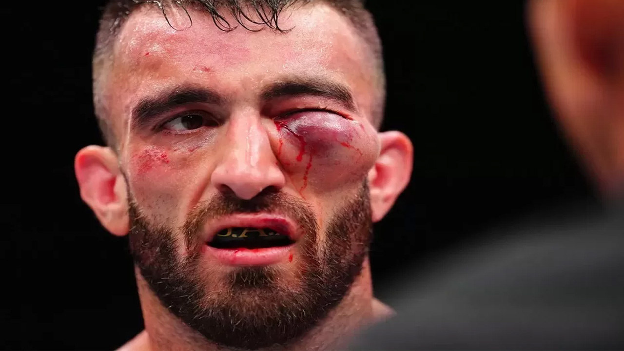 Cedera Parah Mohammad Yahya di UFC Abu Dhabi Gegerkan Penggemar